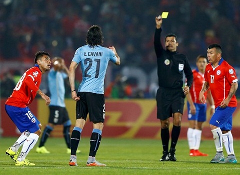 Cavani bi the do oan trong tran dau tai Copa America 2015